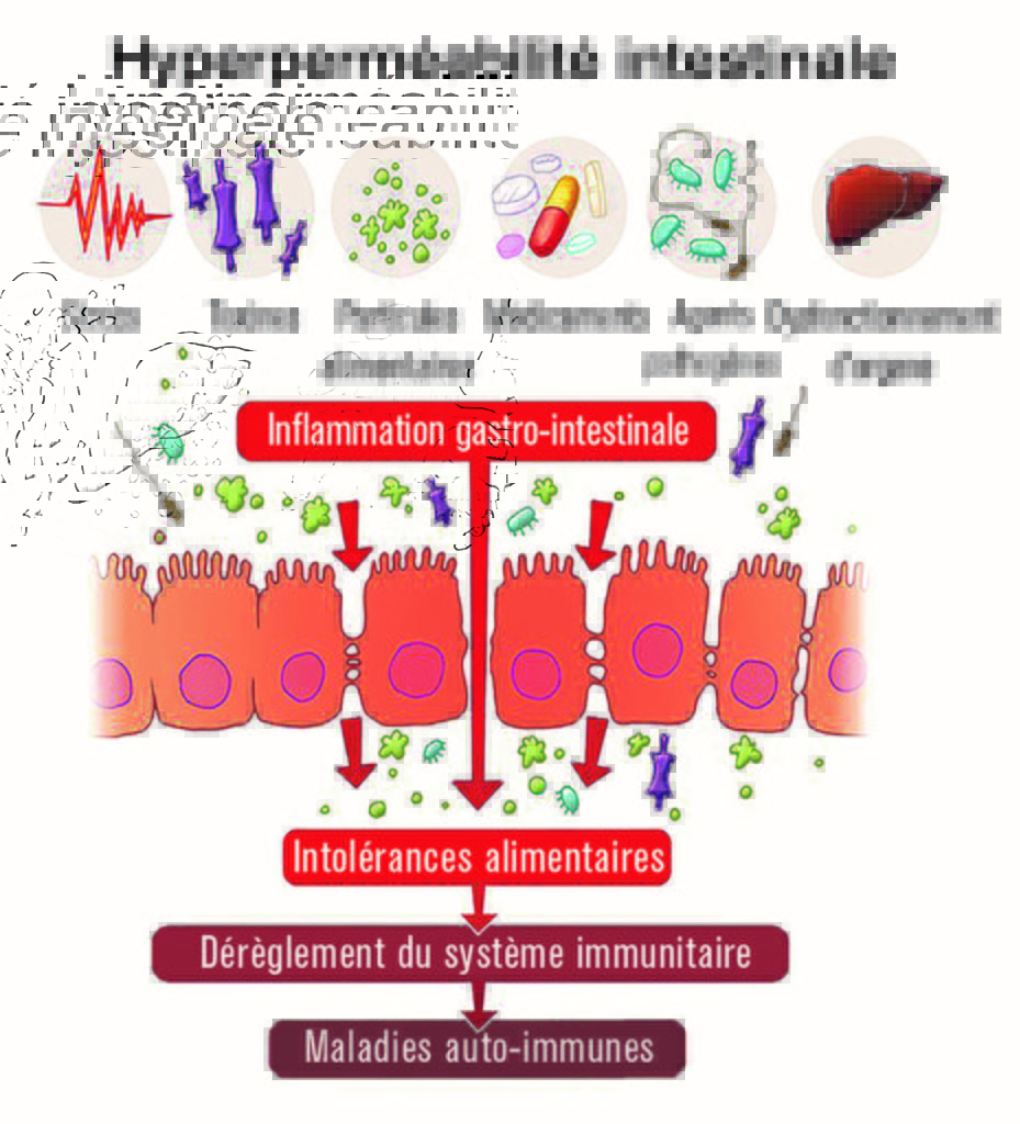 Schéma de l'hyperperméabilité intestinale