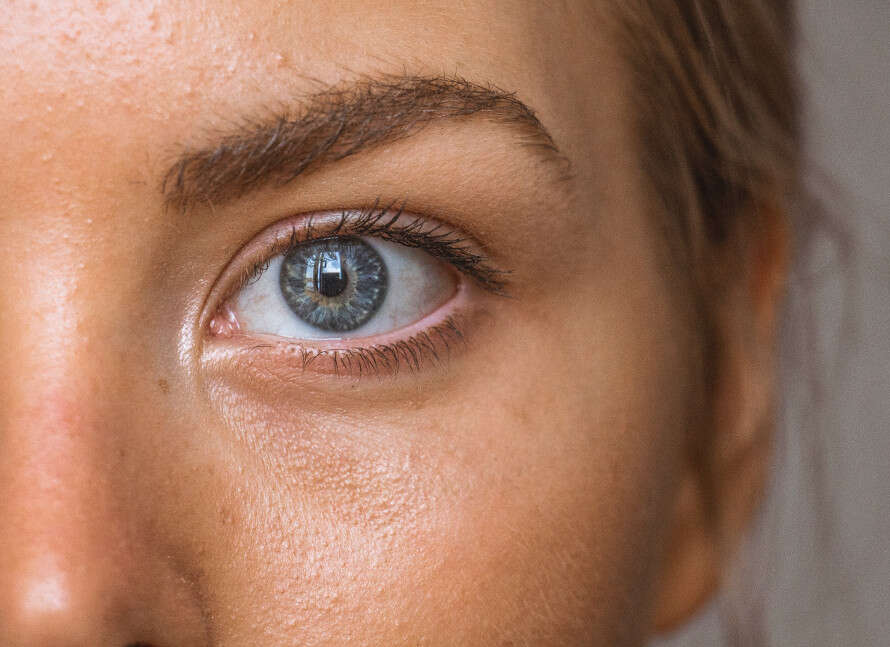 acné adulte hormonale solutions durables et naturelles